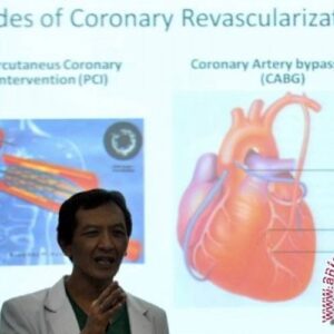 8 penyebab penyumbatan pembuluh darah otak yang wajib diketahui
