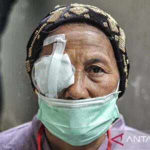 Kenali ciri-ciri mata katarak berikut ini