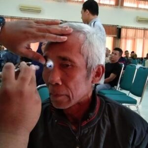 Kenali 13 penyebab katarak dan tips jaga kesehatan mata