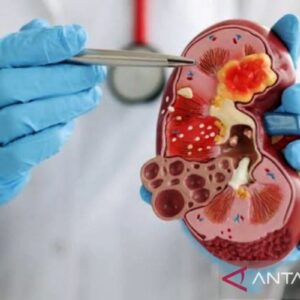 Kenali tanda-tanda penyakit ginjal sejak dini untuk pencegahan